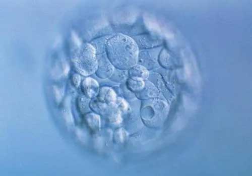 怎么样的胚胎才会养囊？与年龄、卵泡质量、精子质量等有关！
