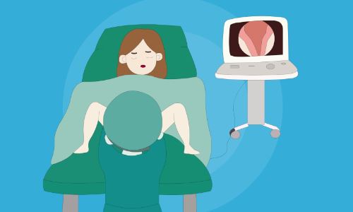 宫腔镜手术检查需要休息几天？输卵管积水能自然受孕吗？